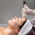 Microdermabrasion in Zürich and the Role of Mental Wellness Services in Modern Skin Care